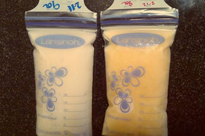 Farbveränderung: Deshalb postet eine Mutter ihre abgepumpte Muttermilch im Internet