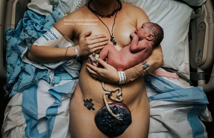Diese preisgekrönten Geburtsfotos sind atemberaubend