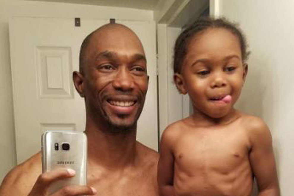 Wow: Dieser Vater trägt für seinen Sohn eine Magensonde