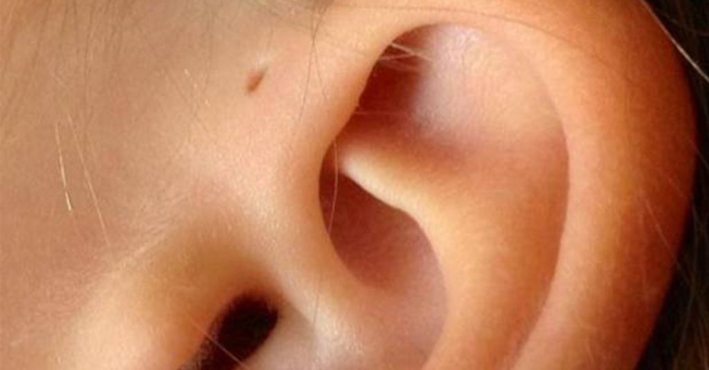 Aha: Deshalb haben manche Menschen Mini-Löcher an den Ohren