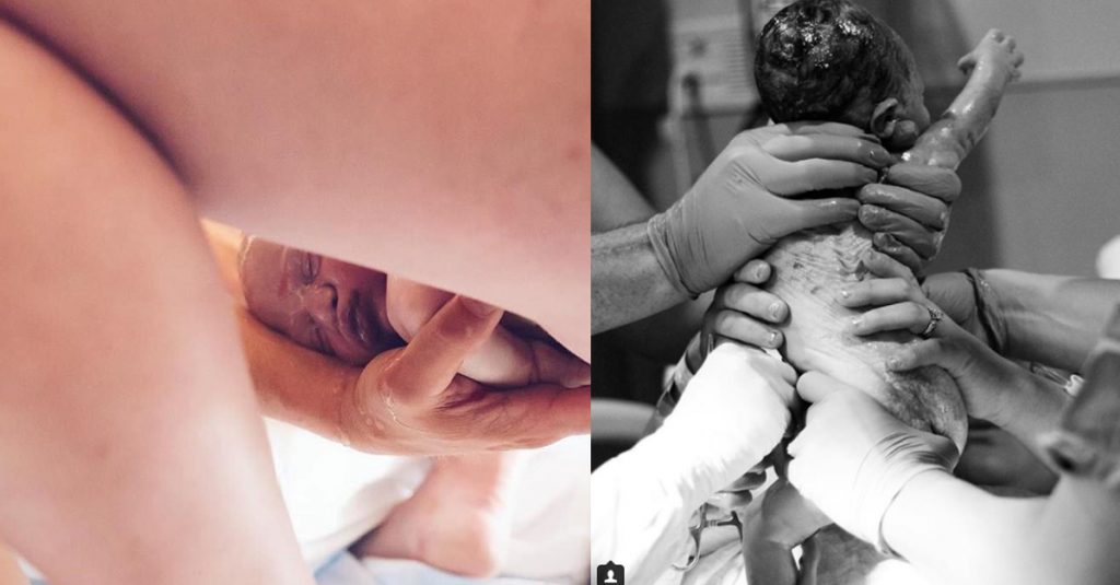11 wundervolle Fotos von der Geburt