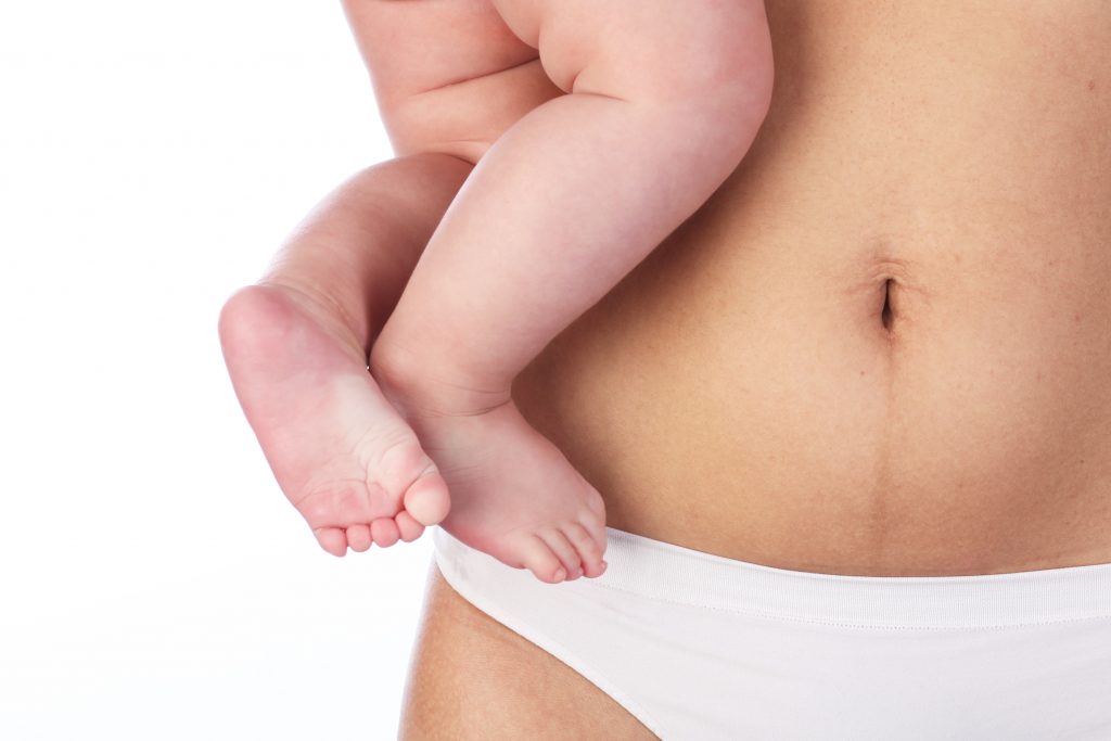 Mein Mama-Bauch im gelben Overall: Über einen Frauenkörper nach der Schwangerschaft