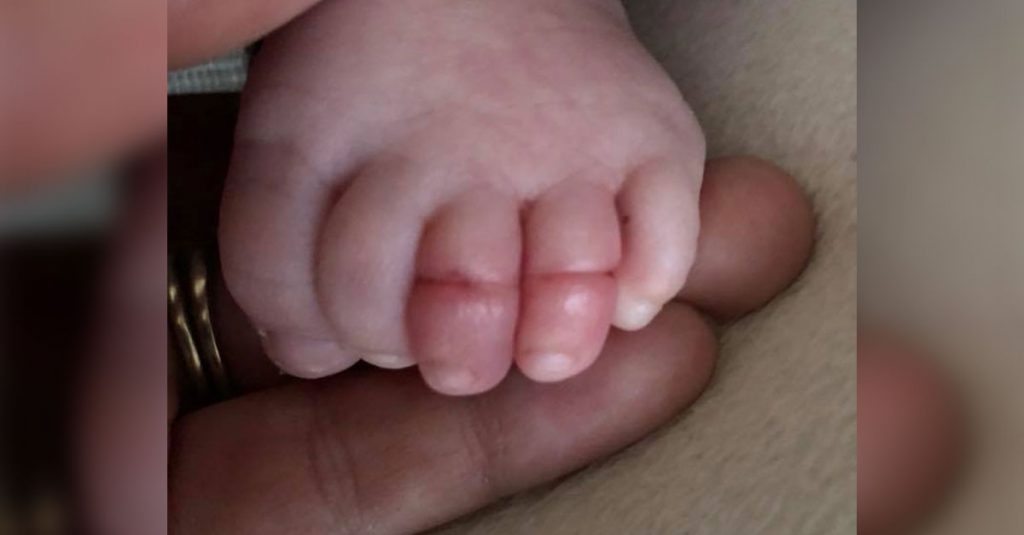 Unachtsam: Diesem Baby müssen beinahe zwei Zehen amputiert werden
