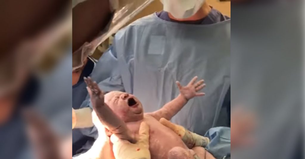 Kaiserschnitt: Diese Mutter zieht sich ihr Baby selbst aus dem Bauch